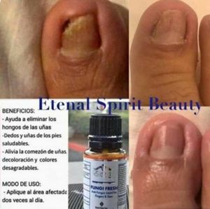 Eternal Spirit Beauty Fungi Fresh/ Anti-Fungus